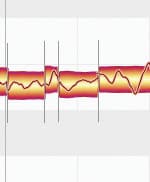 15-break-blob-to-fix-wobble-in-note-pichi